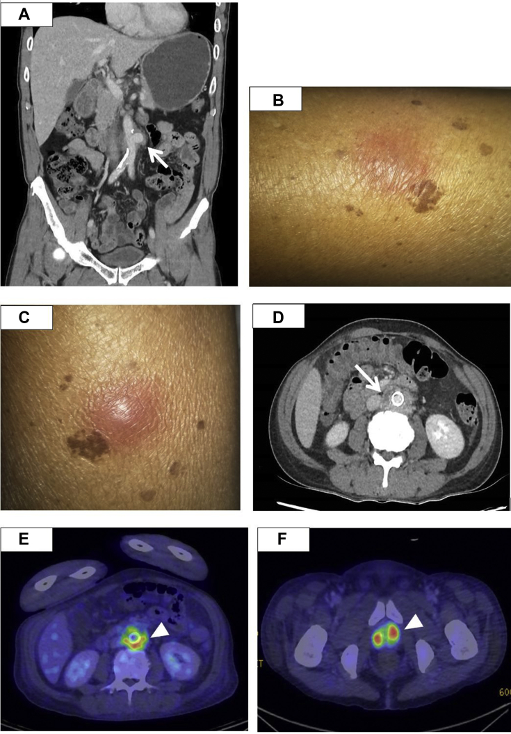 Fig 1