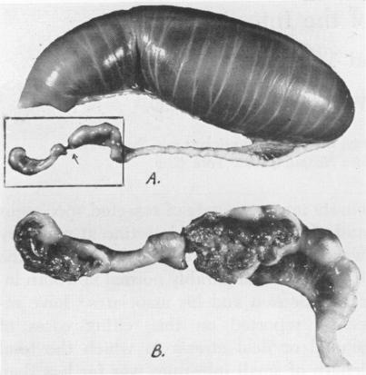 Fig. 1A.