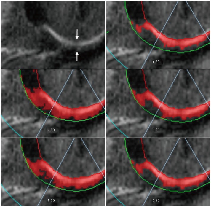 Fig. 12