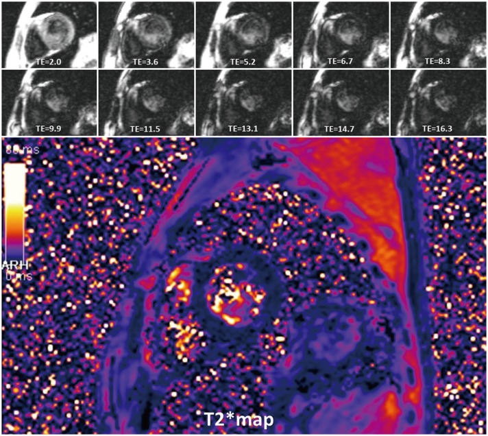 Fig. 17