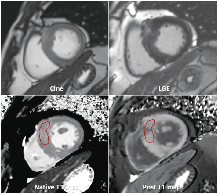 Fig. 18