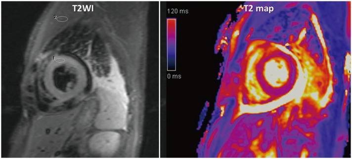 Fig. 16