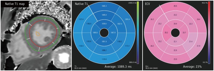 Fig. 14