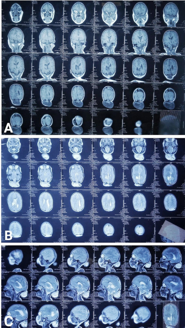 Fig.3