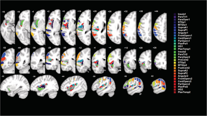 FIGURE 2