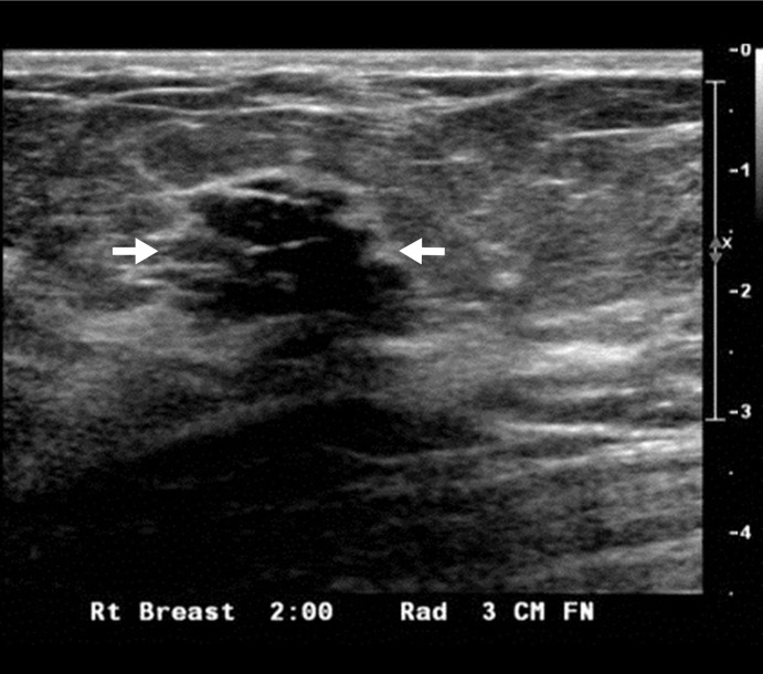 Figure 3a: