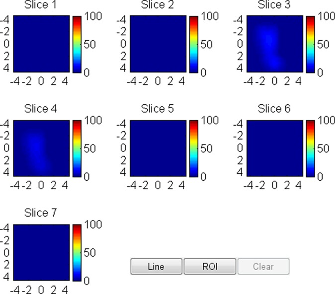 Figure 3d: