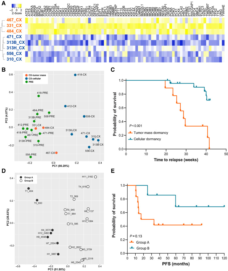 Figure 3. Two subtypes of castration-induced prostate cancer dormancy were associated with disease progression. A, A 42-gene set generated by GSEA Leading Edge analysis (tumor mass dormancy, orange; versus cellular dormancy, blue). B, PCA using the Leading Edge gene set demonstrated a clear split between eight PDXs in cellular dormancy and three in tumor mass dormancy. The latter were grouped closely to precastration samples. C, Kaplan–Meier estimate of PFS in PDXs showed that PDXs displaying tumor mass dormancy had a significantly shorter time to relapse (P < 0.001). D, PCA based on the same Leading Edge gene set separated 18 patients treated with preoperative ADT (NHT) into two subgroups (groups A and B; n = 7 and n = 11, respectively). E, Kaplan–Meier of patients in the two subgroups (P = 0.13). PC, principal component.