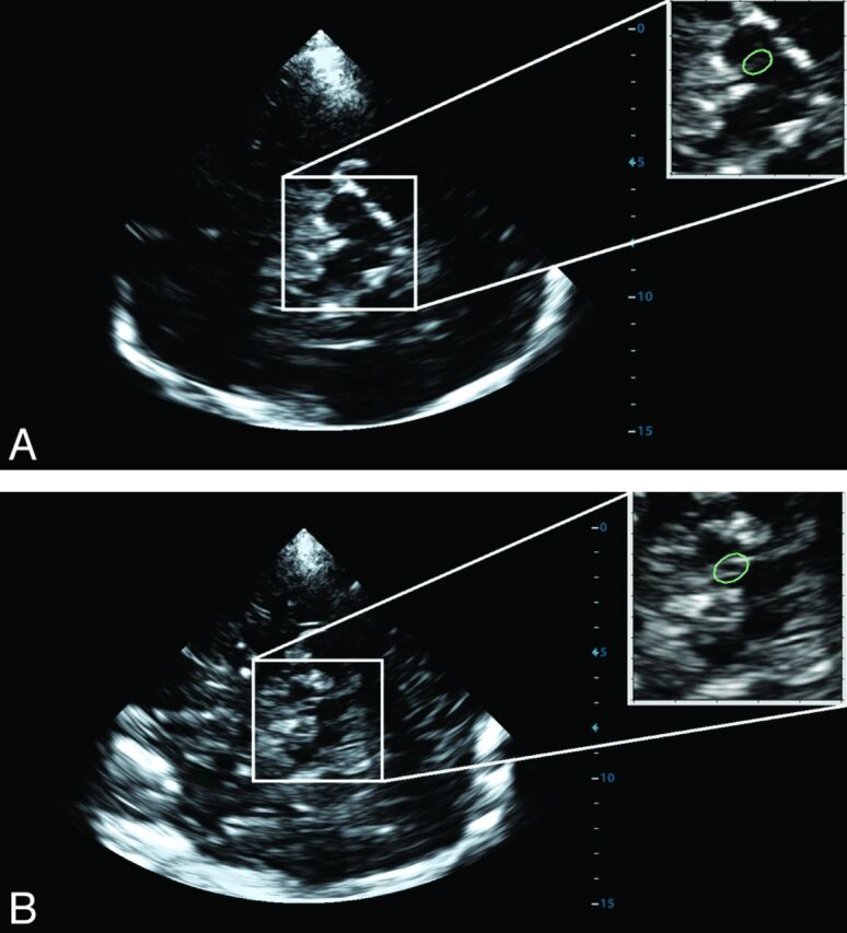 Fig 2.