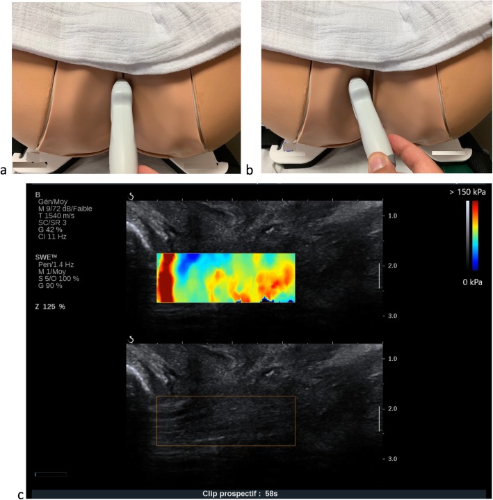 Fig. 2