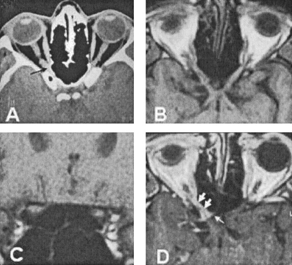 Fig 1.