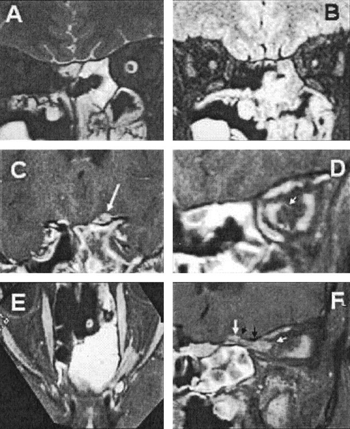 Fig 2.