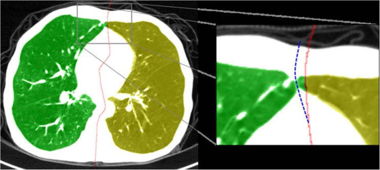 Fig. 11