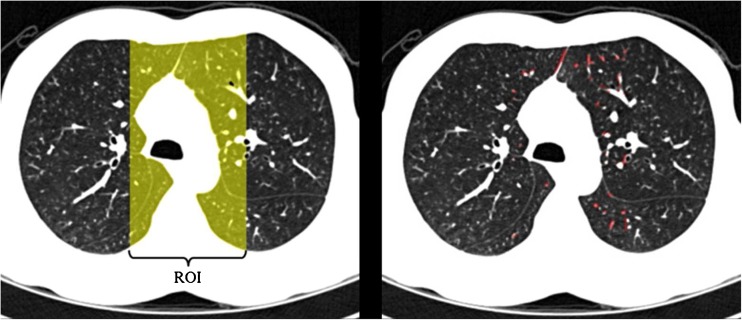 Fig. 4