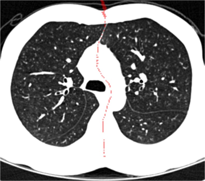 Fig. 7