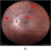 Fig. 2a