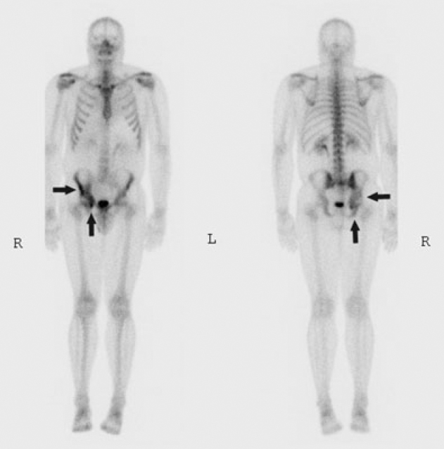 Figure 1C