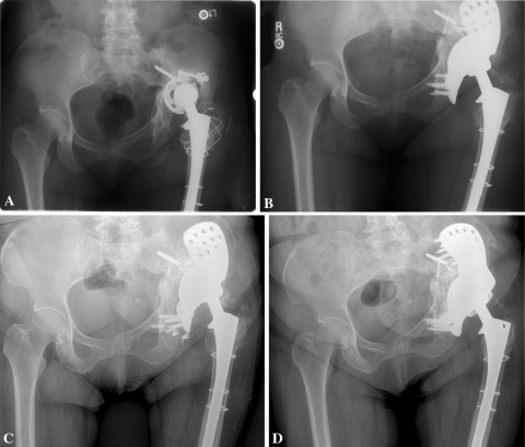 Fig. 2A–D