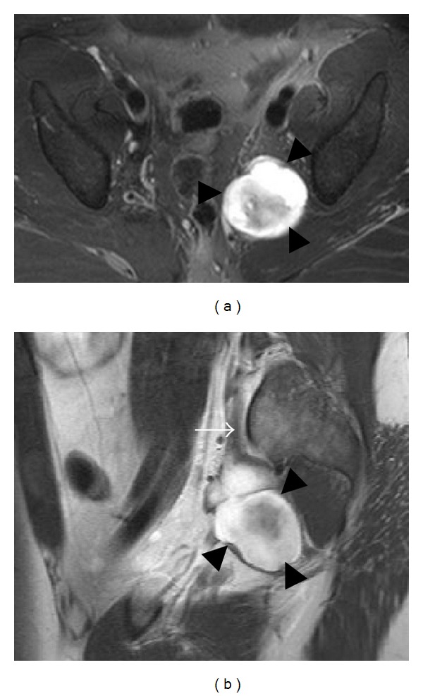 Figure 16