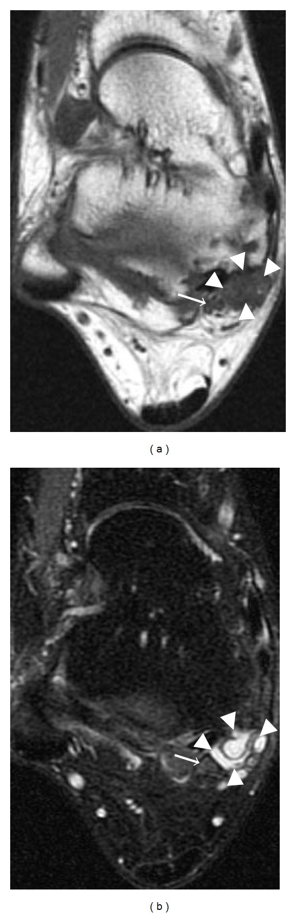 Figure 20