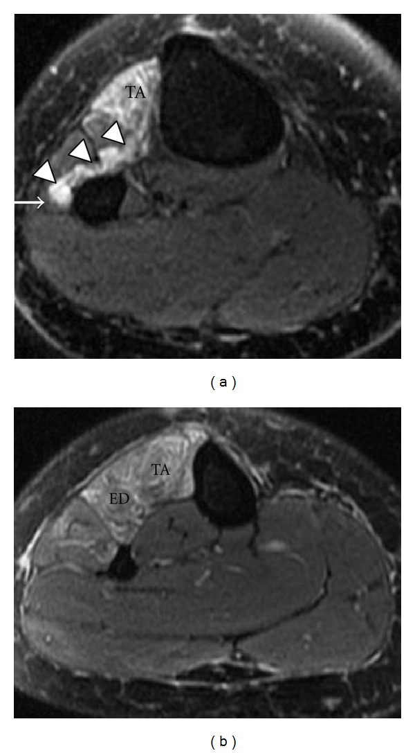 Figure 18