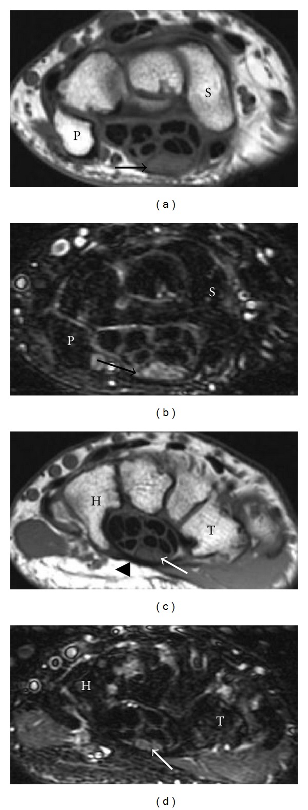 Figure 13