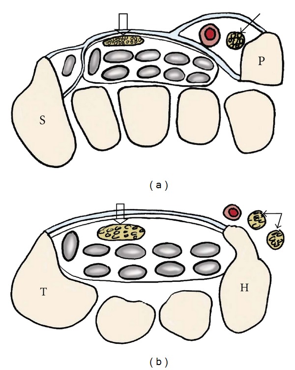 Figure 10