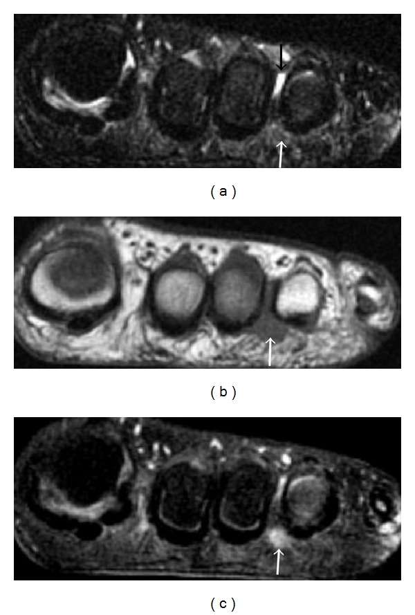 Figure 22