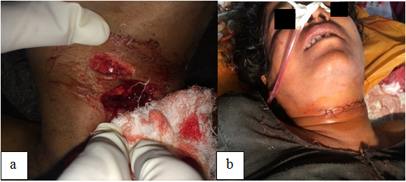 [Table/Fig-5]: