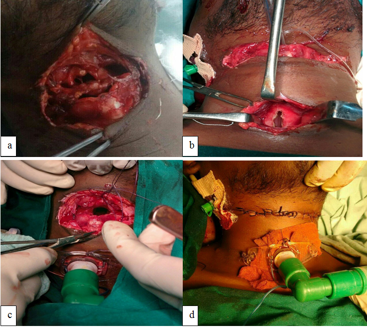 [Table/Fig-4]: