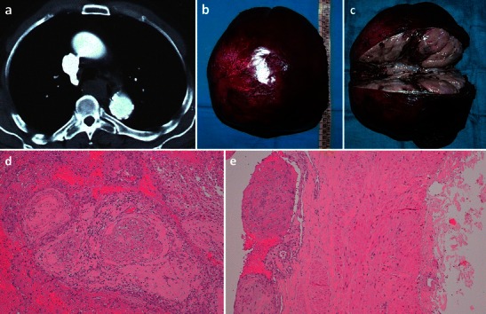 Fig. 10