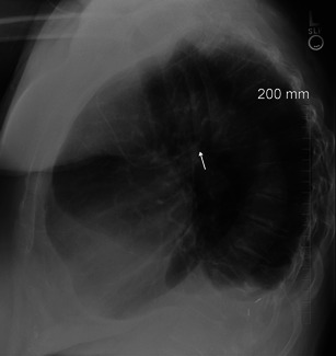 Fig. 11