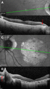 FIGURE 3