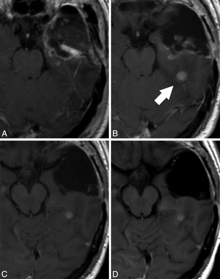 Fig 2.