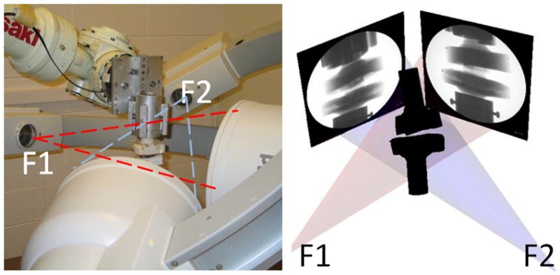 Fig 2