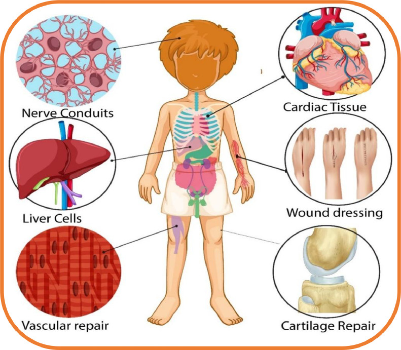 Fig 13