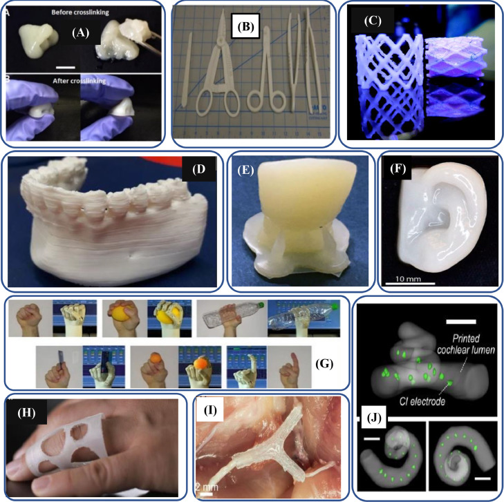 Fig 16