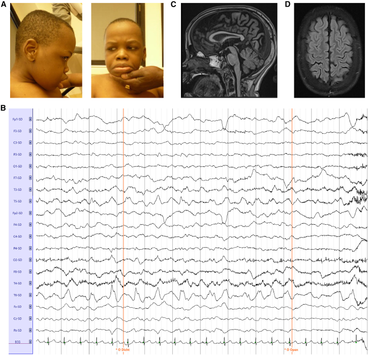 Figure 1