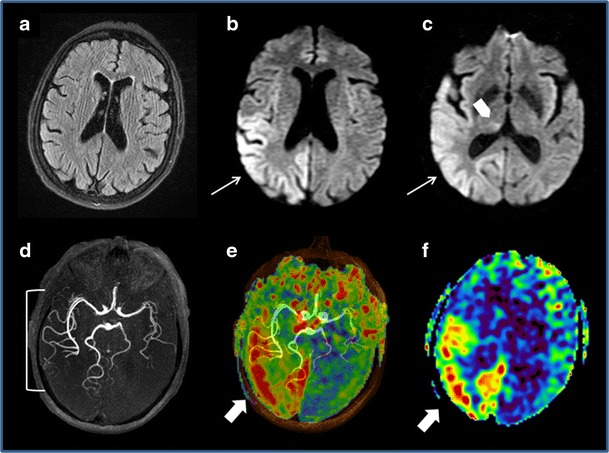 Fig. 7