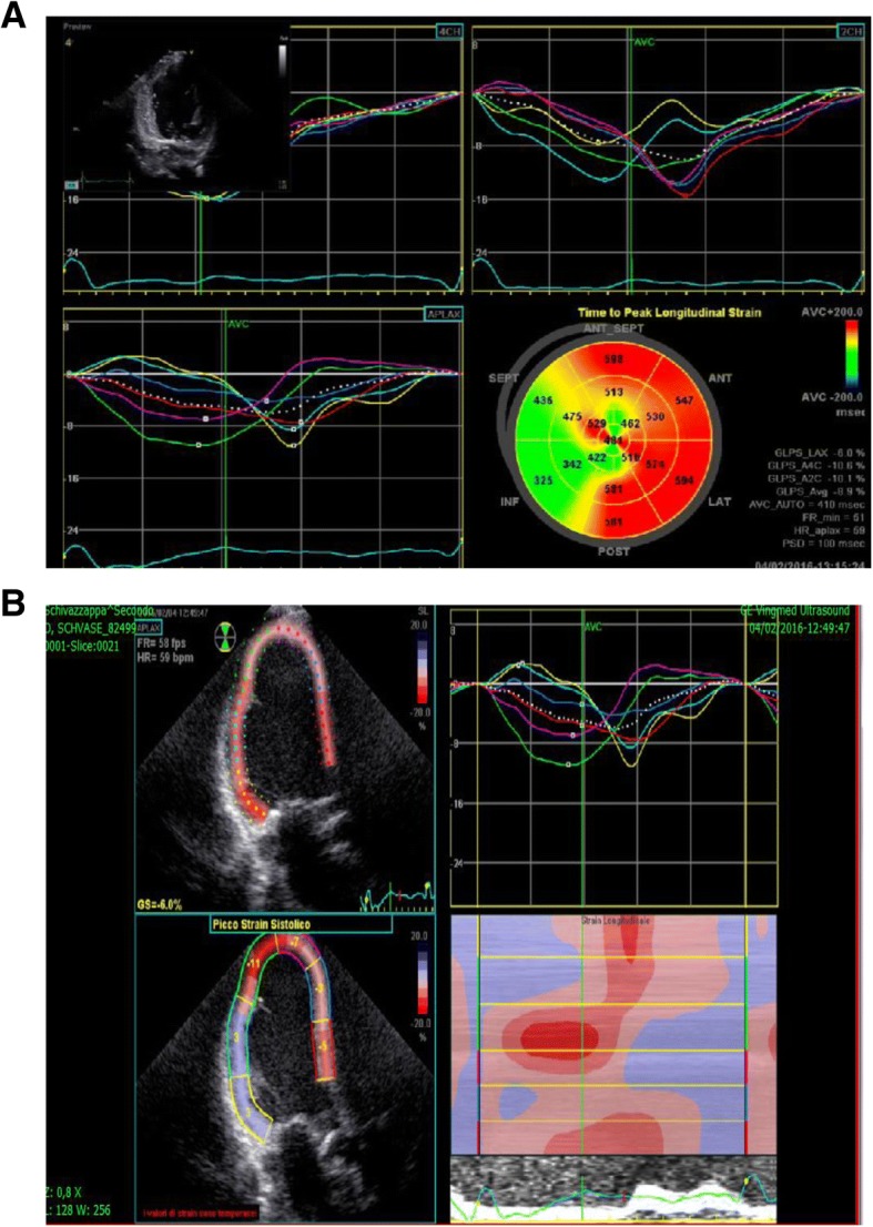 Fig. 2