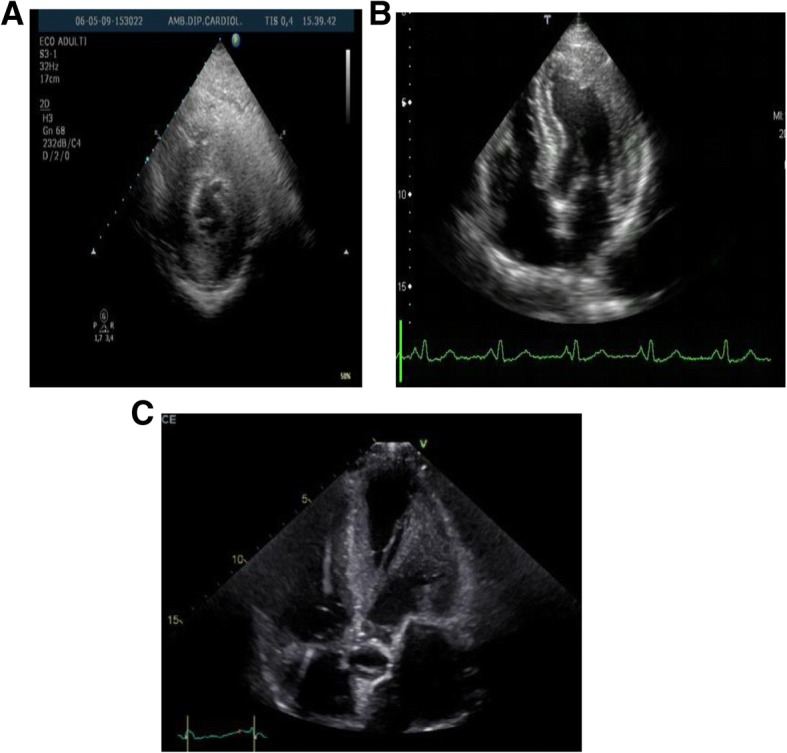 Fig. 1