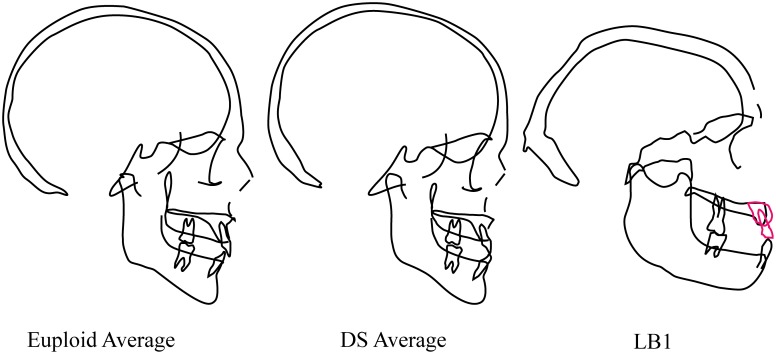 Fig 4