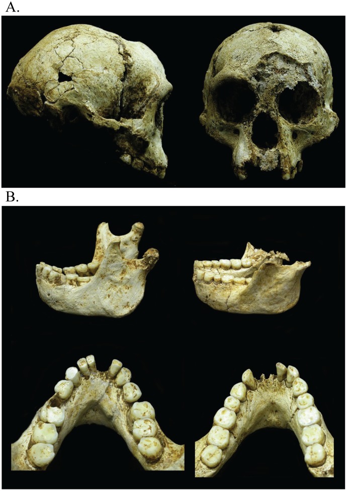 Fig 1