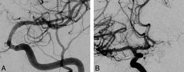 Fig 3.