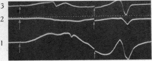 Fig. 18B