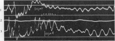 Fig. 13