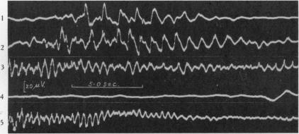 Fig. 14