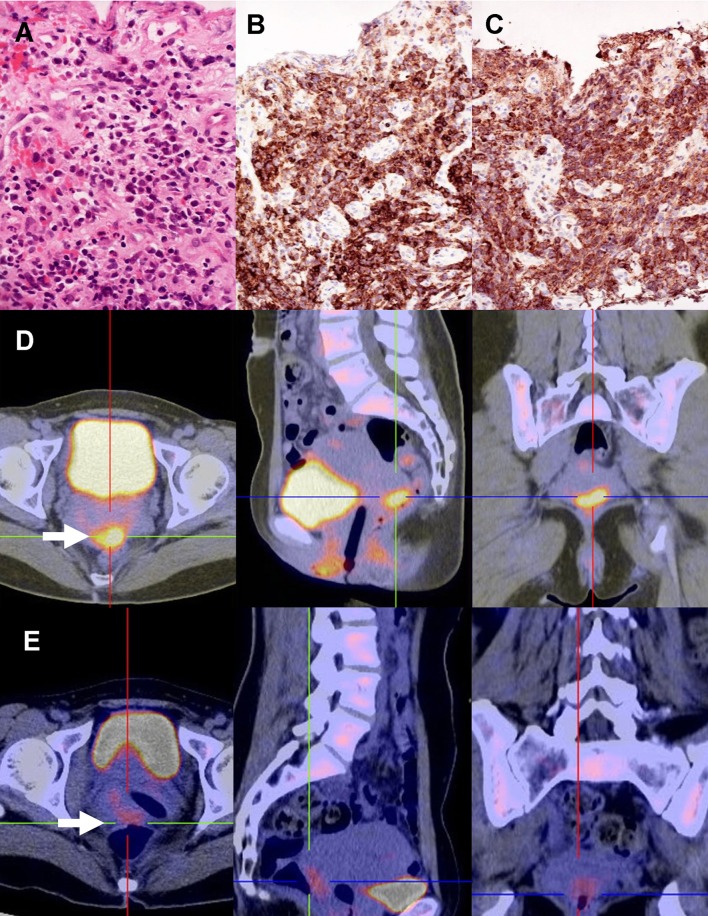 Fig. 1