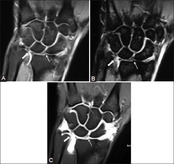 Figure 3 (A-C)