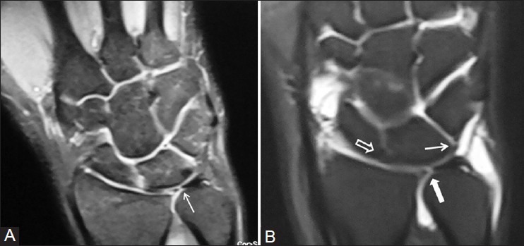 Figure 4 (A and B)